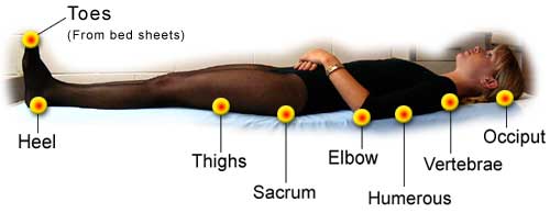 Supine patient positioning and portal designation. (A) Supine position